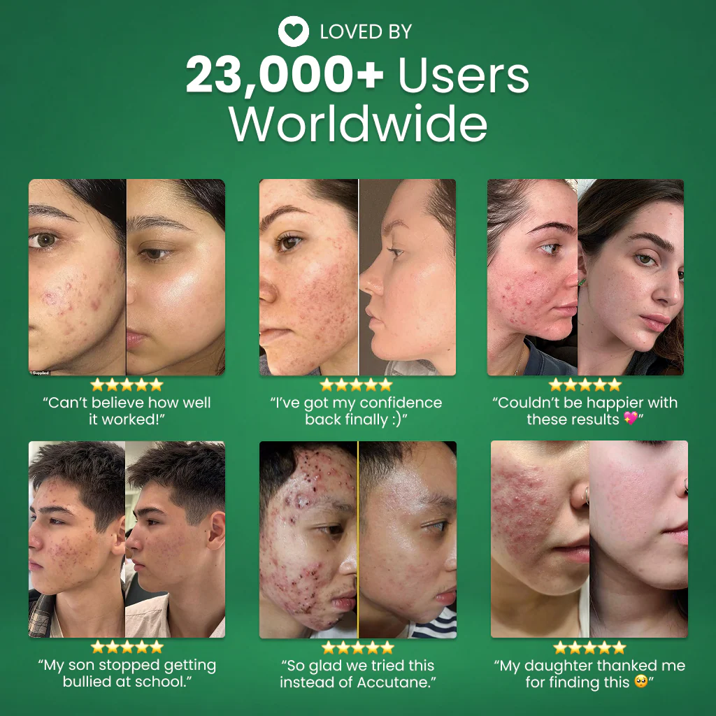 Skinfora Daily Gut-Skin Probiotic